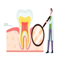 Periodontal Disease (Gum Disease): Symptoms, Causes & Treatment
