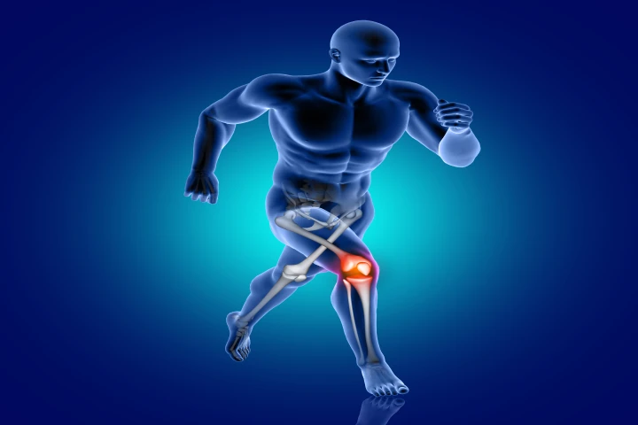 Natural Remedy for Joint Pain